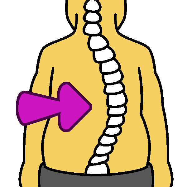 A yellow person in gray pants with a spine curving far to the right, and a pink arrow pointing into the curve.